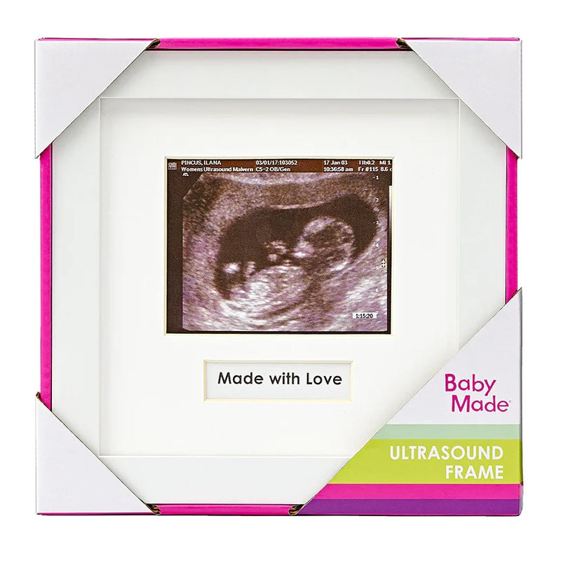 Ultrasound Frame